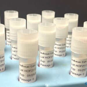 Hofbauer Cells (Macrophages)